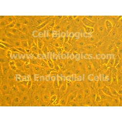 ZDF Rat Diabetic Aortic Endothelial Cells